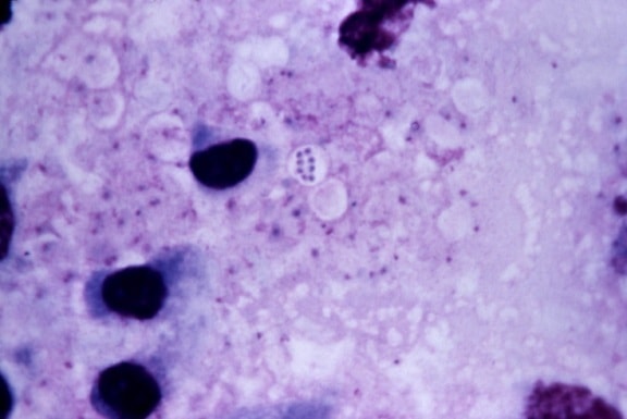 micrograph välikarsinan imusolmukkeiden solmua, cynomolgus, apina, macaca fascicularis, hengittäminen, ja pernarutto