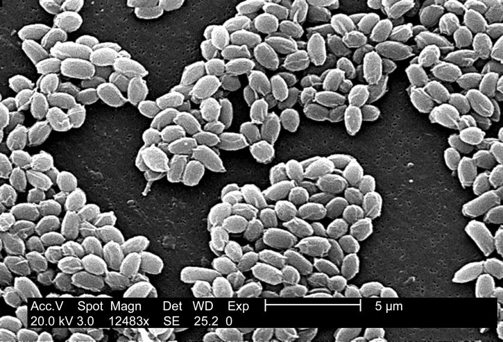 mikroskop-bilde, sporer, sterne, belastning, bacillus anthracis, bakterier