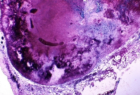 photomicrograph välikarsinan imusolmukkeiden solmua, cynomolgus, apina, macaca fascicularis