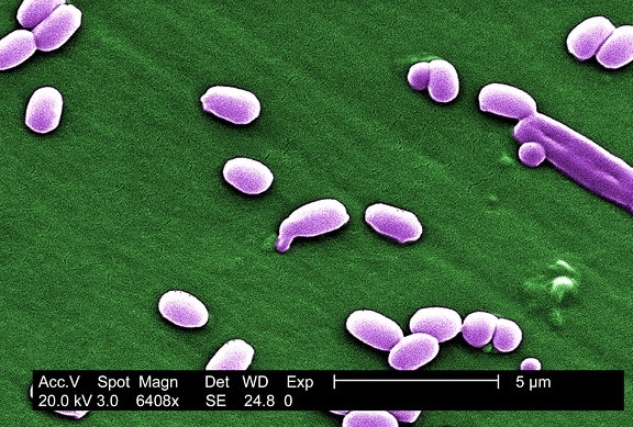 skanning, elektron mikroskop-bilde, sporer, aimes, belastning, bacillus anthracis, bakterier