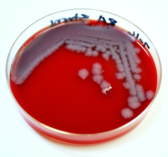 bild bacillus anthracis, bakterier, kolonier