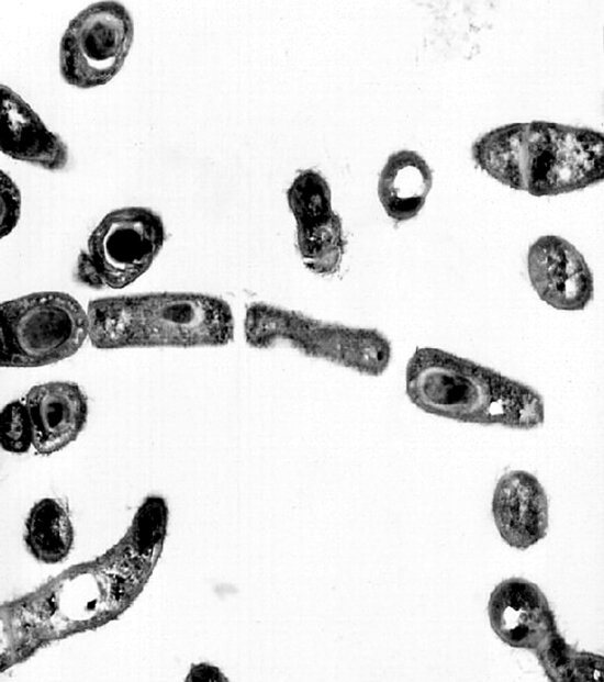 透射,电子显微图像,芽孢杆菌,炭疽