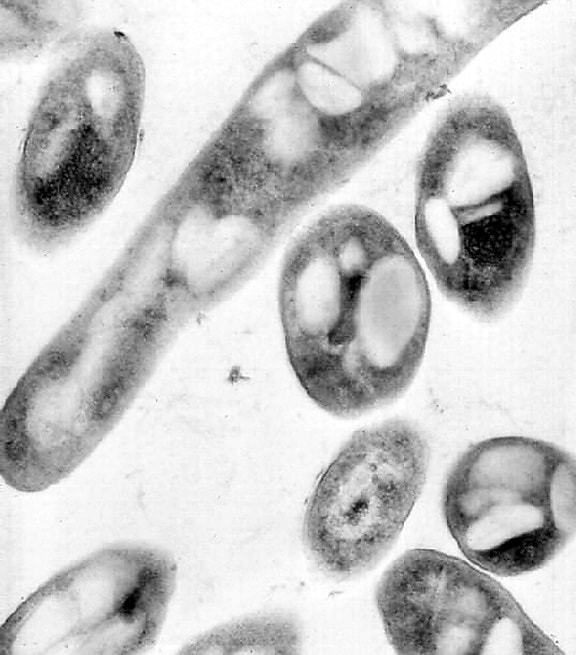 transmission, electron micrograph, bacillus anthracis, close