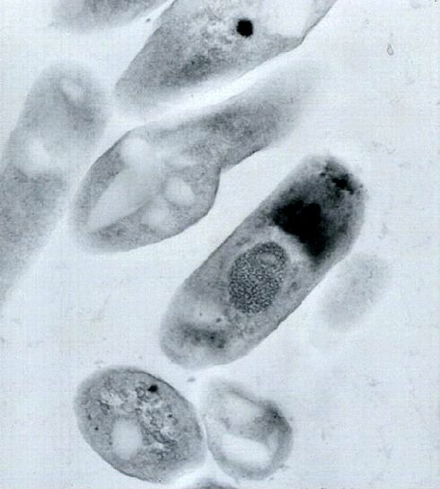 передача електронна мікрофотографія bacillus, сибірської виразки, virions
