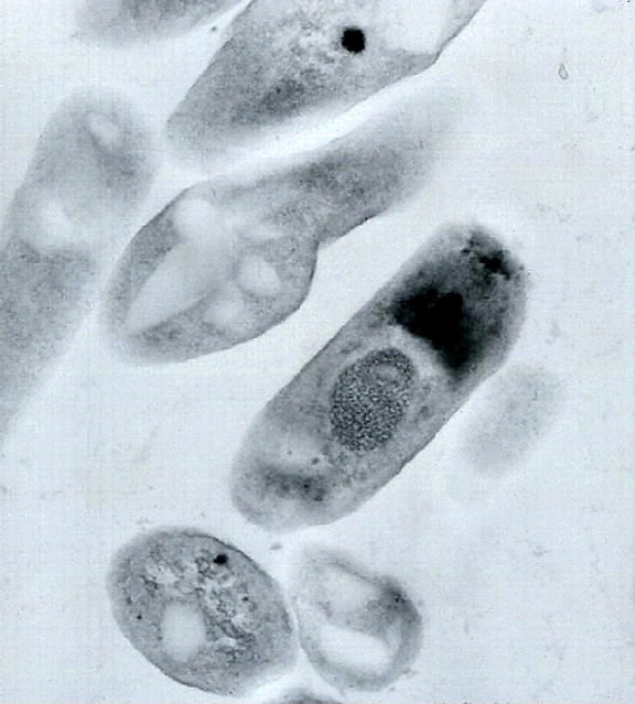 transmission, electron micrograph, bacillus anthracis, virions
