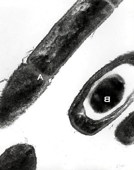 Transmission electron micrographic, afbeelding, bacillus anthracis, miltvuur, cultuur