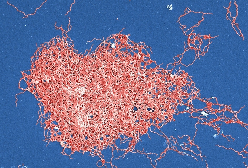 Borrelia burgdorferi s l днк обнаруж