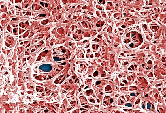 burgdorferi, belongs, group, bacteria, spirochetes, whose, appearance, resembles, coiled, spring