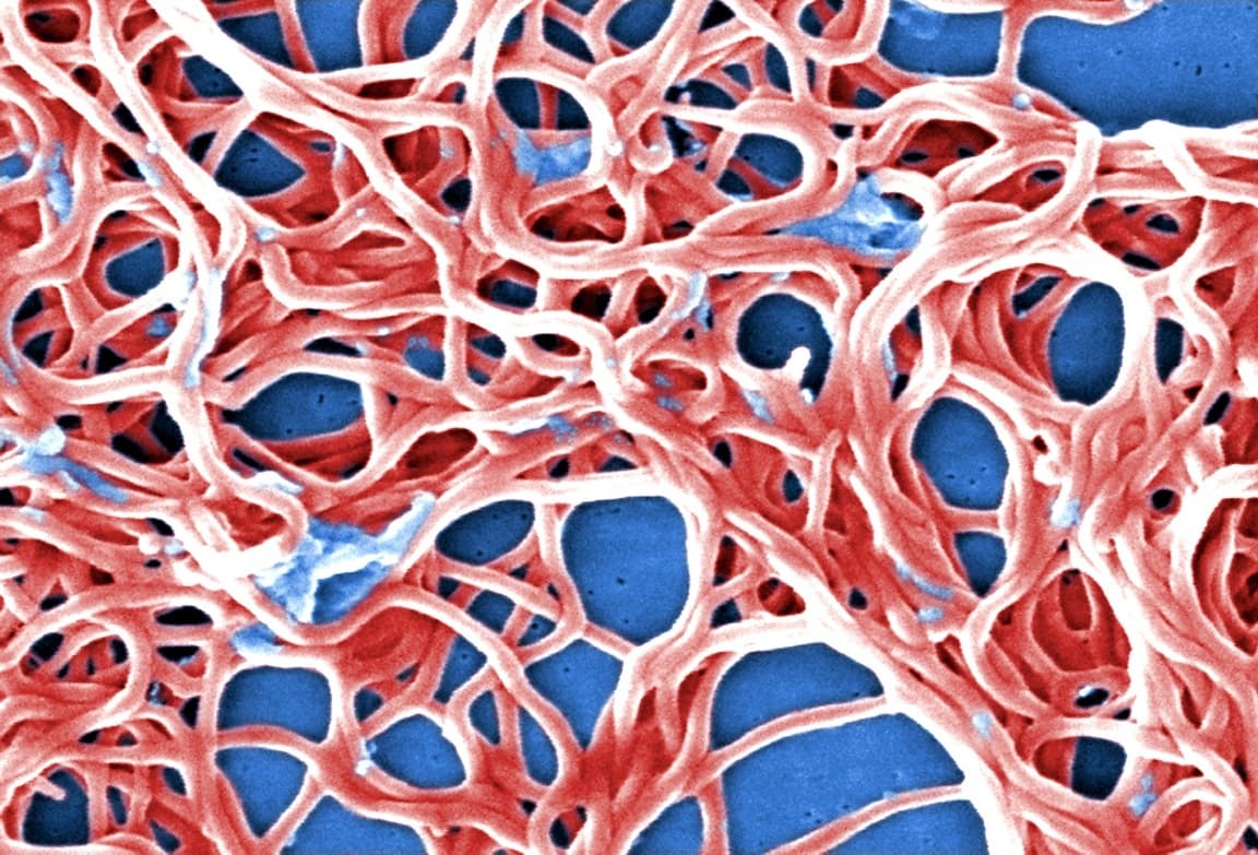 Borrelia burgdorferi s l днк обнаруж