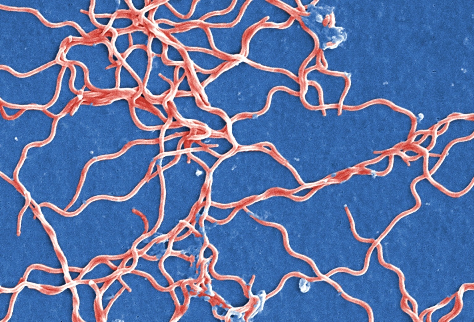 Borrelia burgdorferi s