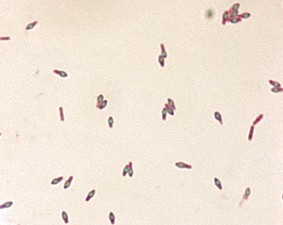 Free picture: photomicrograph, clostridium botulinum, type, gram, stain ...