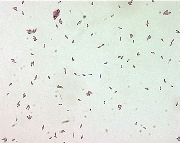 Clostridium ботулизма, споры, малахит, зеленый, пятно