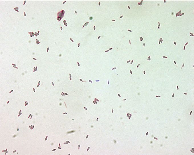 Clostridium botulinum sporer, Malakit, grøn, pletten