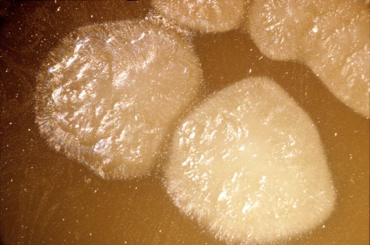 Clostridium botulinum, tipo, colonias, pantalla, opaca, zona, crecido, 48hr, huevo, yema de huevo, agar, placa, mag