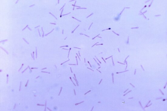 clostridium cell, genus, anaerobic, spore, forming, bacteria