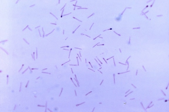 clostridium celulares, género anaeróbico, esporas, bacterias, formando