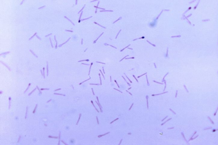 Clostridium bunky, rodu, anaeróbne, spore, tvárnenie, baktérie