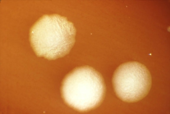 το Clostridium γένος, αναερόβια, σπορίων, σχηματίζοντας, βακτήρια, οικογένεια, bacillaceae, clostridium botulinum