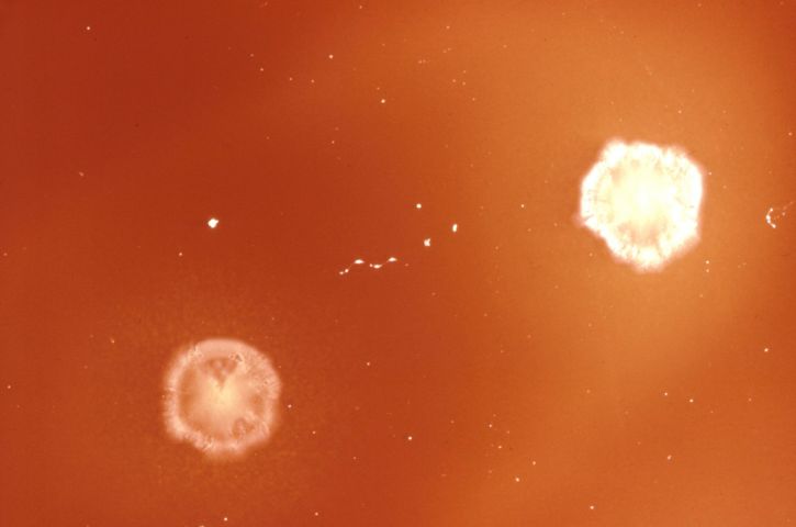 batteri Clostridium, cellule, genere, anaerobico, spore, formando, batteri, famiglia, Bacillaceae