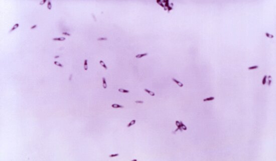 clostridium subterminale, bacteria, blood agar, plate
