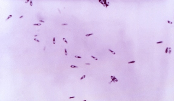 Clostridium subterminale, bakterier, blod agar, plate