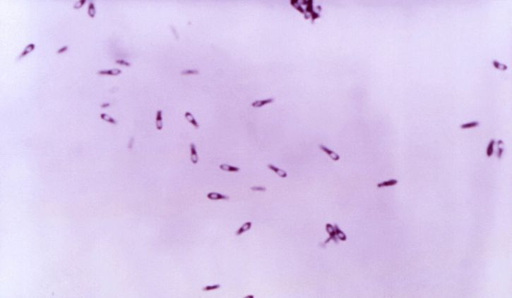 Clostridium subterminale, bakterie, krevní agar, deska