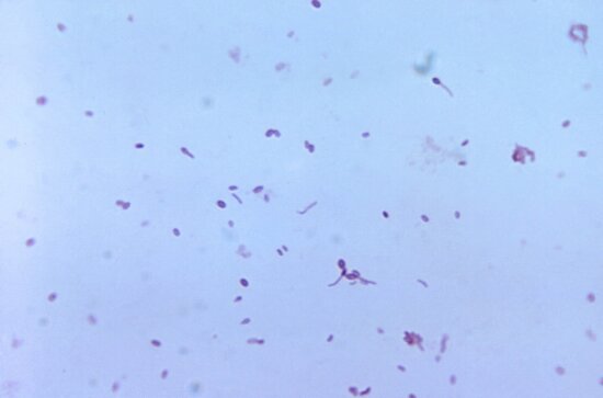 gram, positive, clostridium tertium, bacteria, blood agar, plate
