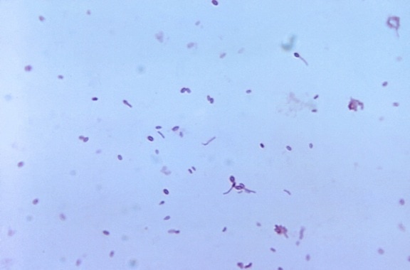 gram, positive, clostridium tertium, bakterier, blod agar, plate