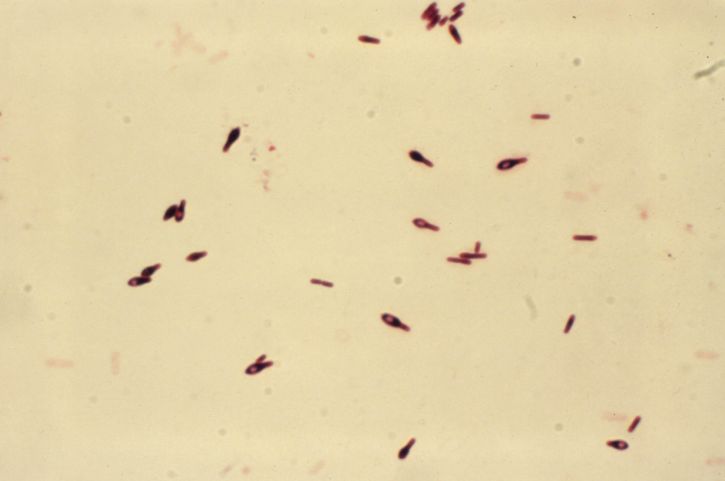 グラム、顕微鏡写真、ボツリヌス菌、型、thioglycollate、スープ、培養、48 時間