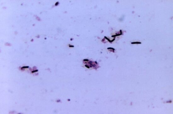 magnified, 956x, gram, photomicrograph, numbers, clostridium gram, positive, bacteria