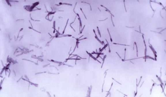 Clostridium παθογόνων, μέλη, perfringens septicum