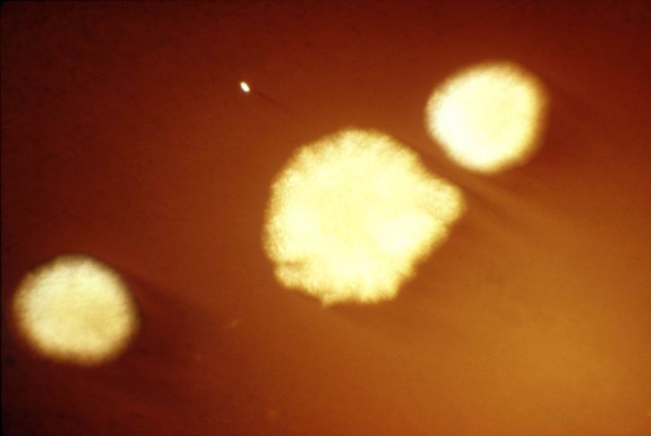 photograph, shows, clostridium subterminale, colonies, grown, blood agar, plate, magnification