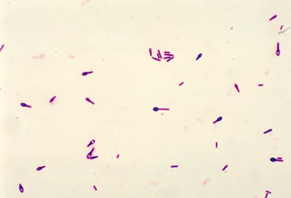 Mikrophotographie, Clostridium botulinum, Typ, Gramm, Fleck, Technik