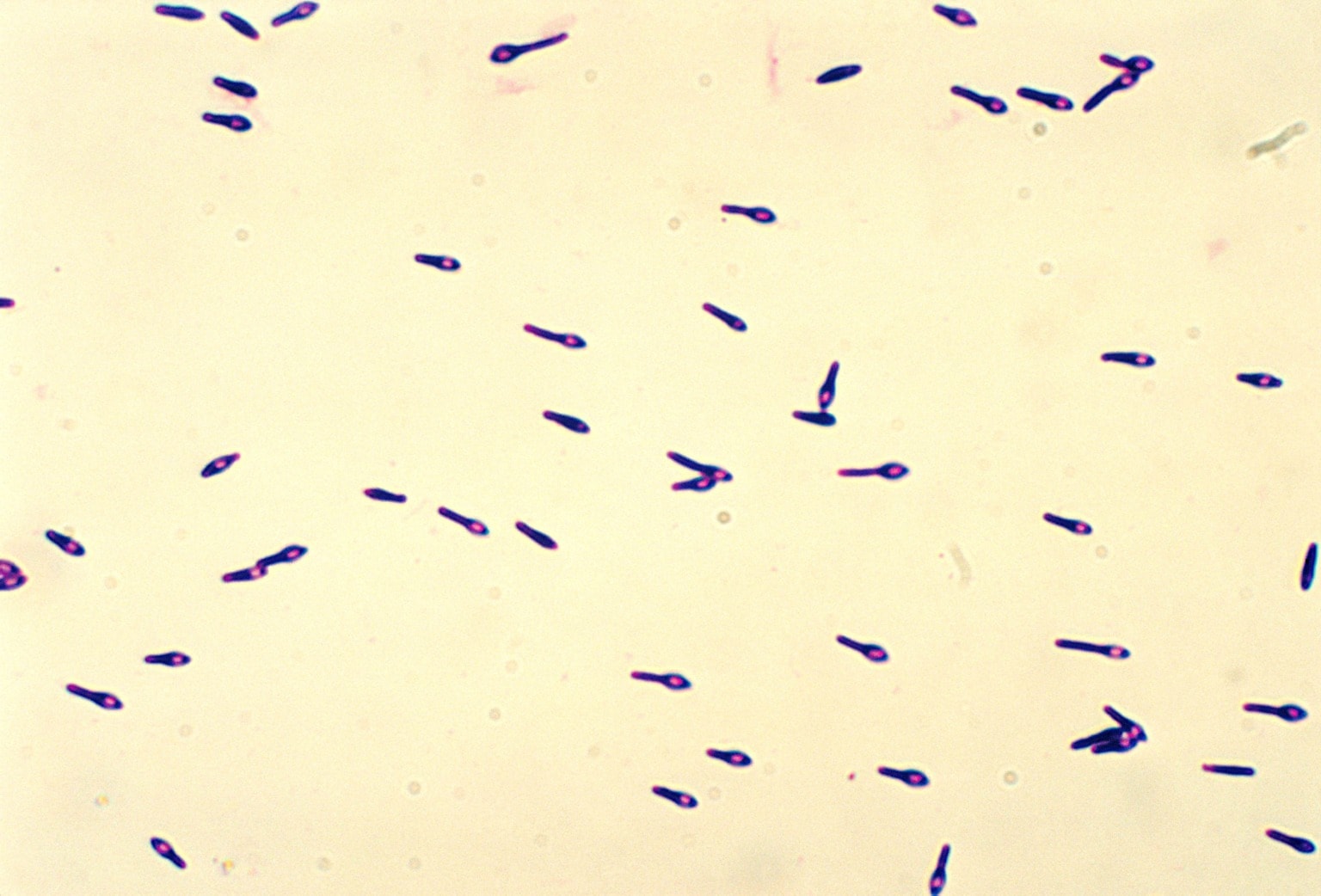 Кластридии. Clostridium septicum микроскопия. Клостридия перфрингенс споры. Клостридиум ботулинум окраска по Граму. Клостридиум перфрингенс возбудитель.