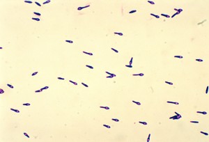 Free picture: clostridium botulinum, type, colonies, display, opaque ...