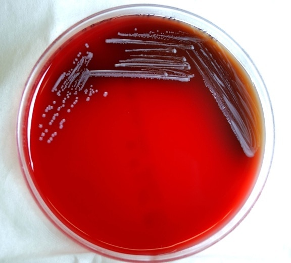 細菌のコロニー、羊、血