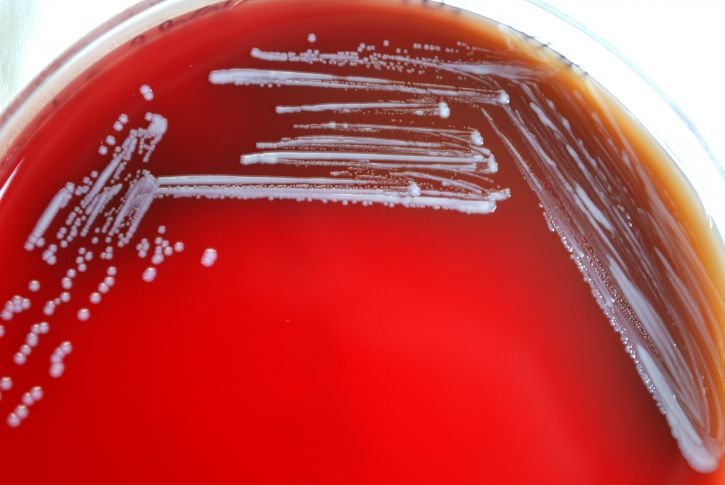 Free picture: blood agar, period, temperature