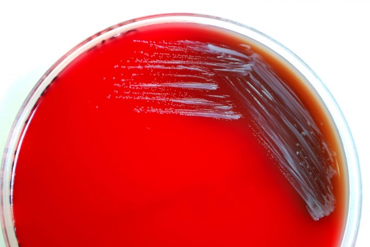 brucella abortus, bacteria, grown, sheep, blood agar