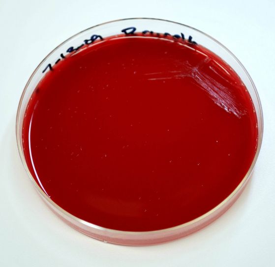 Brucella abortus, bacterii, blood agar