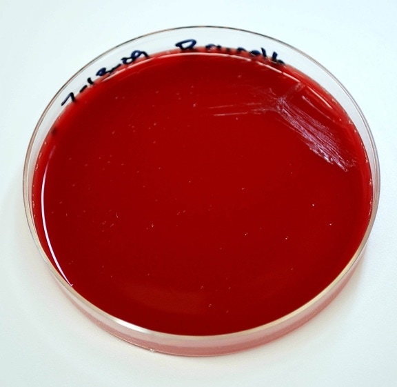 Brucella abortus, bakterier, blod agar