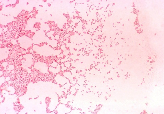 Brucella melitensis, gram negatívne, coccobacillus, zoonózy