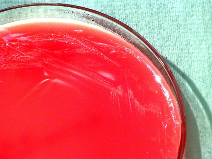brucella bacteria, pathogenic, disease, brucellosis