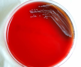 Free picture: brucella abortus, bacteria, grown, sheep, blood agar