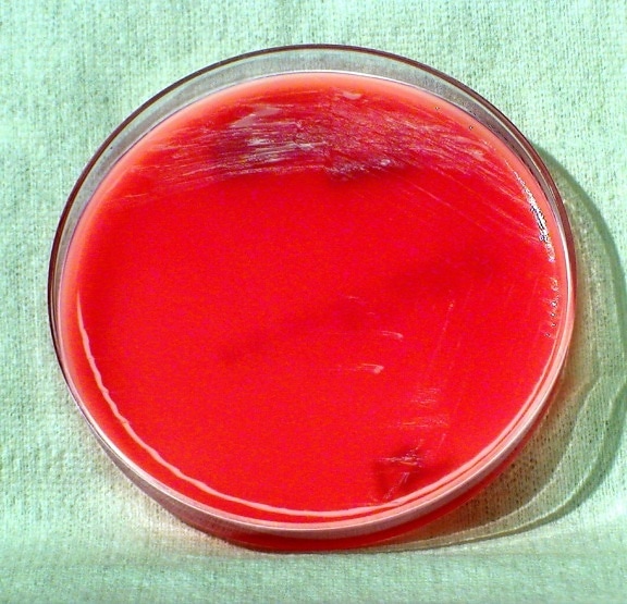 gram, negatywne, brucella melitensis, w bakterii, uprawiane, agar krwi