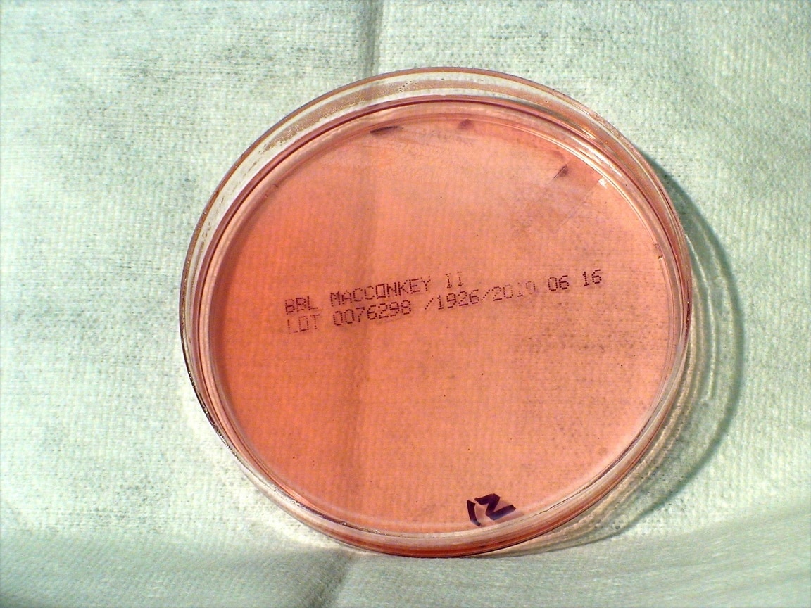 Free Picture: Brucella Melitensis, Gram, Negative, Coccobacillus ...