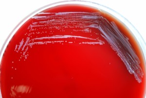 Free picture: gram negative brucella abortus bacteria grown blood agar