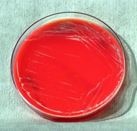 bacteriacolonized, módosított thayer, martin, agar