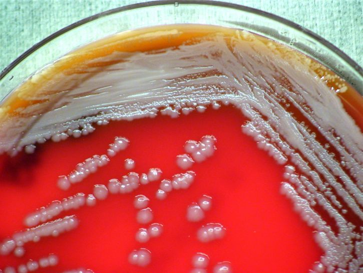 burkholderia thailandensis, lampaita, bakteerit, laboratorio, verestä valmistetulle elatusaineelle testaus