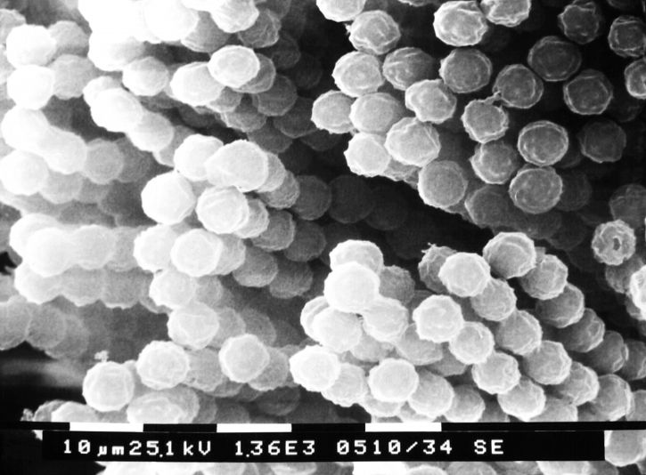 Zincirler, aspergillusfungal conidiospores
