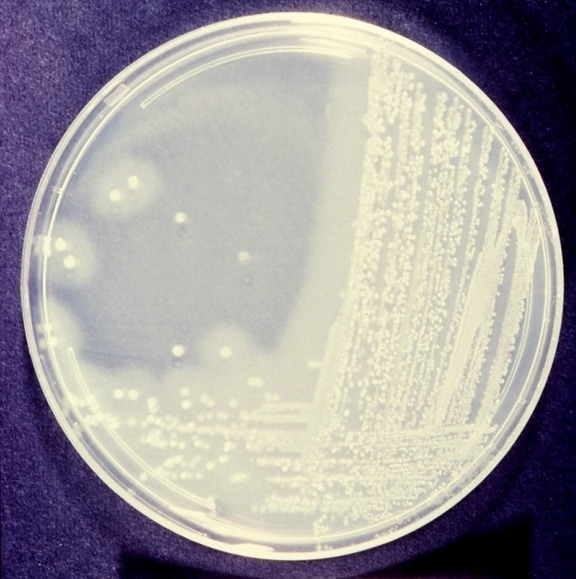 gelatin, agar, identification, bacteria, vibrio cholerae, causal, agent, cholera